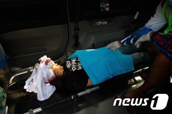 병원으로 후송되는 미얀마 시위 부상자 © AFP=뉴스1